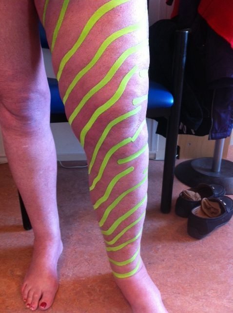 Medical taping behandeling